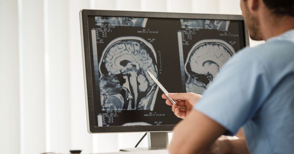 charleston brain injury lawyers